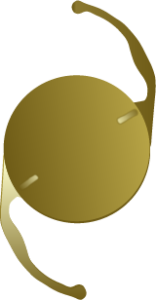 Toric Lens Example