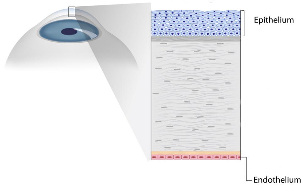 Cornea Transplant Diagram