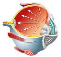 Glaucoma Diagram